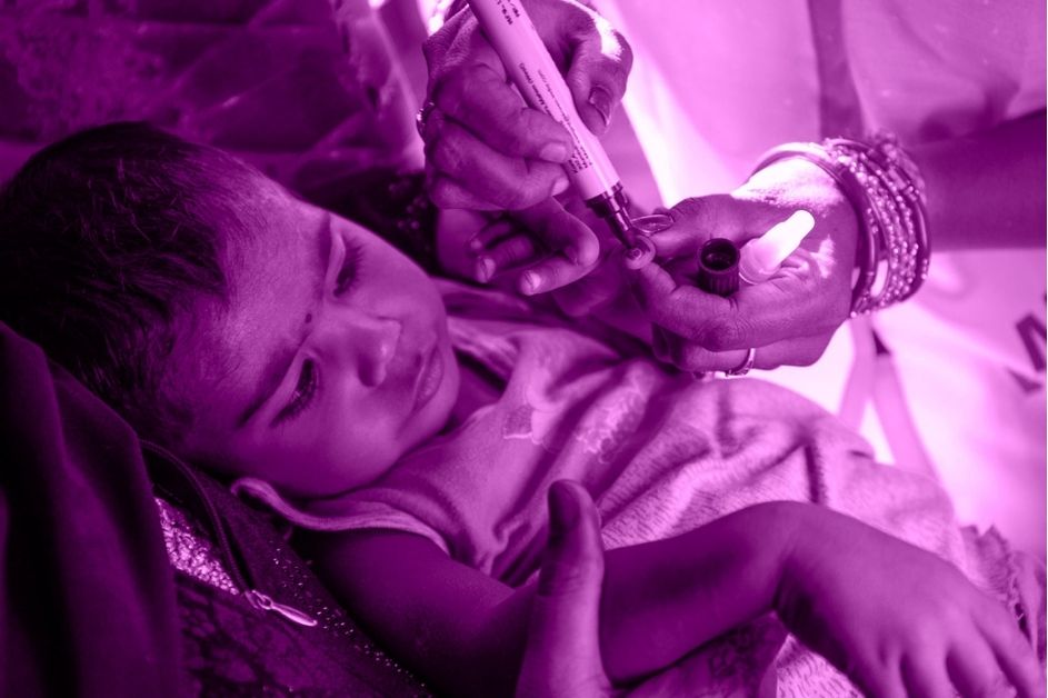 immagine bambino affetto da poliomelite